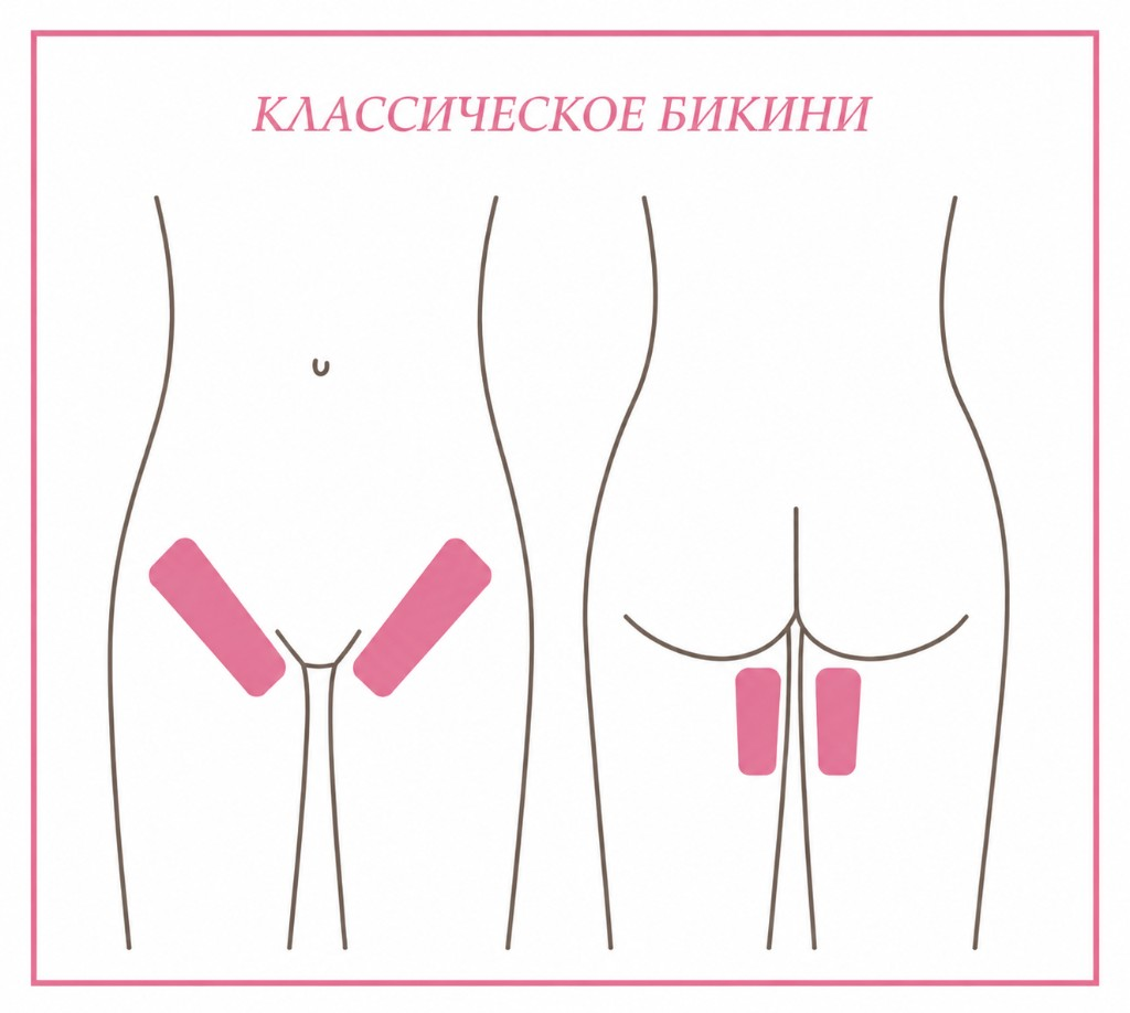 Классическое бикини — схема зоны M: линия белья