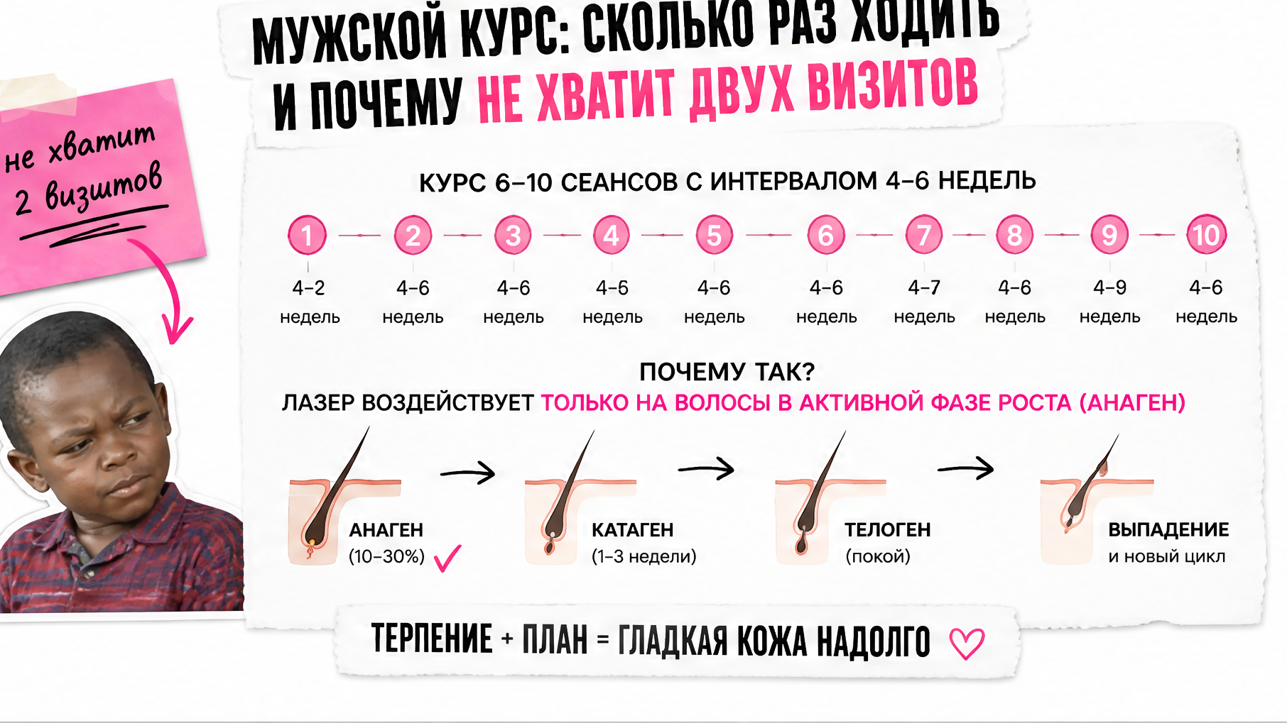 Календарь курса мужской лазерной эпиляции 6–10 сеансов с интервалом 4–6 недель