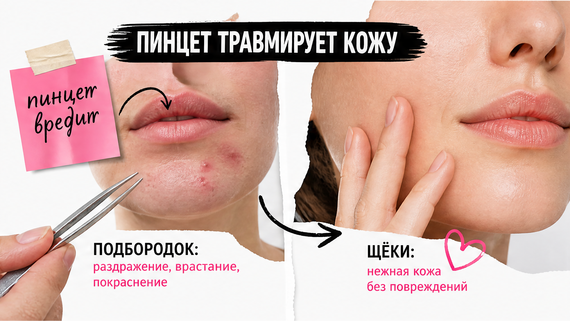 Сравнение: пинцет травмирует подбородок и щёки vs нежная кожа без повреждений
