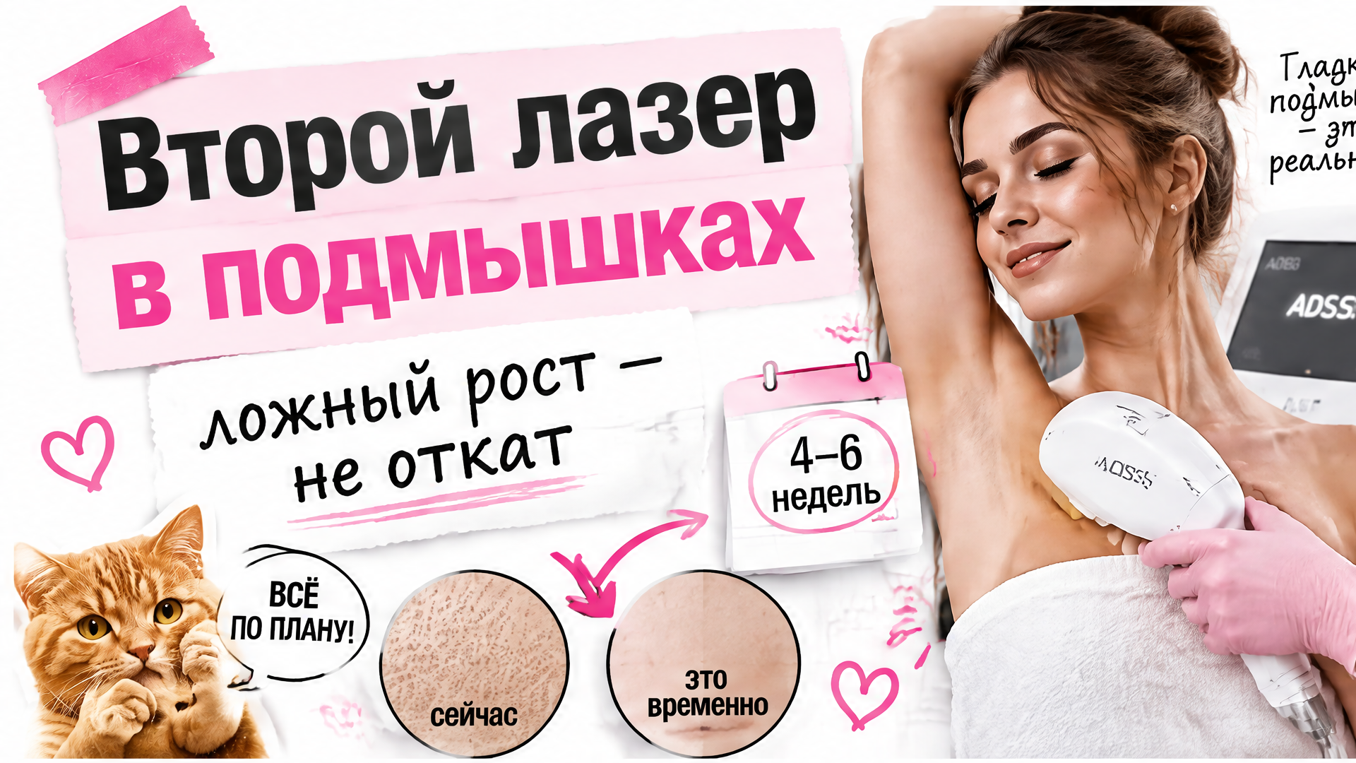 Раздражение в подмышках после лазера: какие кремы спасут от красноты и жжения